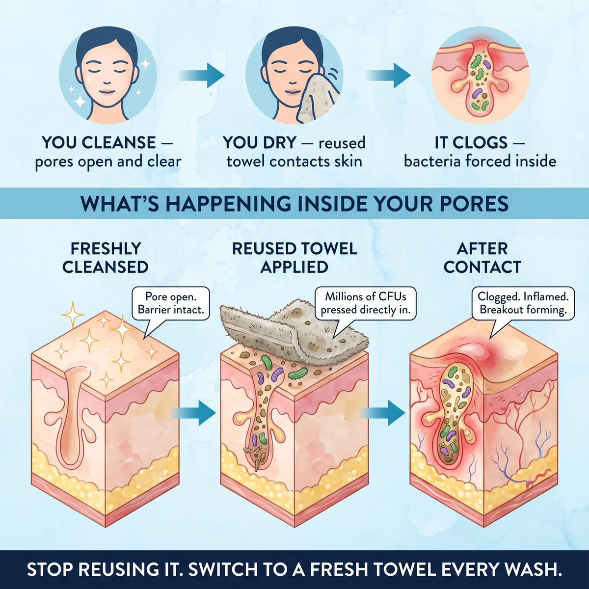 DermaClear™ Face Towels For Acne-Prone Skin