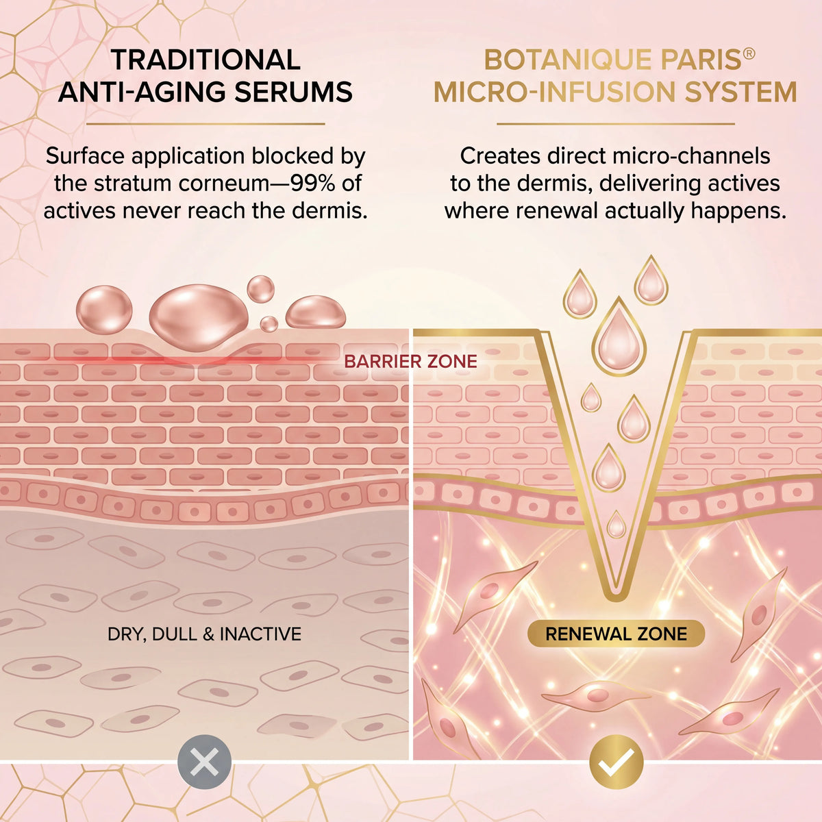 Micro-Infusion System For Eye Bags & Dark Circles