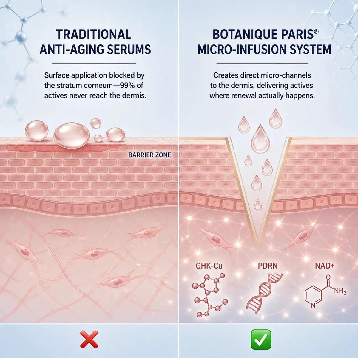 Micro-Infusion System For Hooded Eyelids for Men