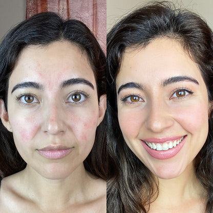 RevitaLight™ Red Light Therapy Face Mask