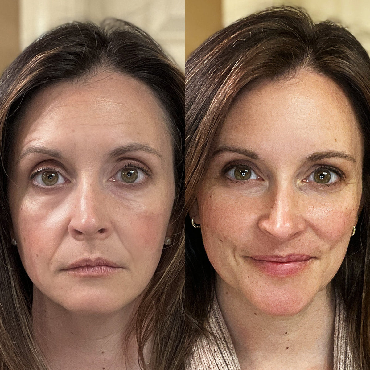 RevitaLight™ Red Light Therapy Face Mask