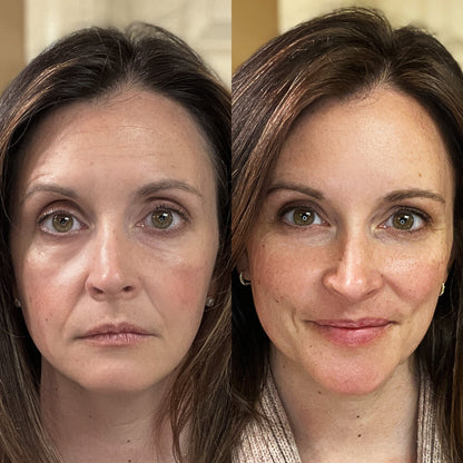 RevitaLight™ Red Light Therapy Face Mask
