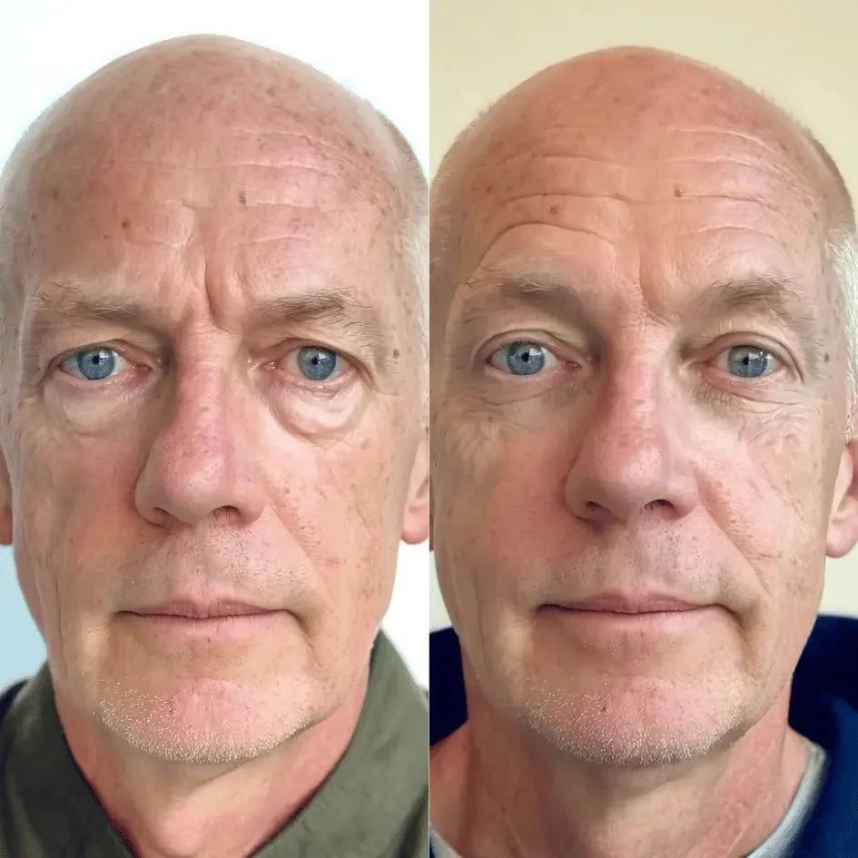RevitalEyes® 2-in-1 Red Light Therapy + EMS To Erase Eye Bags for Men
