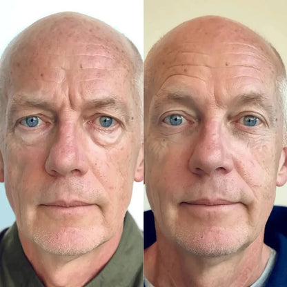 RevitalEyes® 2-in-1 Red Light Therapy + EMS To Erase Eye Bags for Men