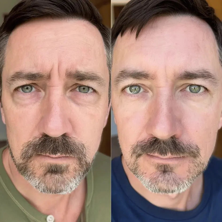 RevitalEyes® 2-in-1 Red Light Therapy + EMS To Erase Eye Bags for Men