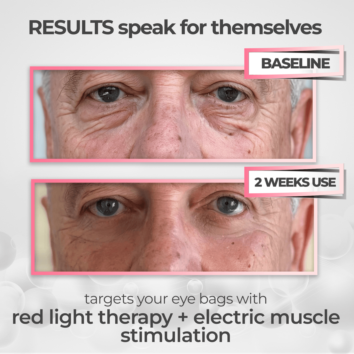 RevitalEyes® 2-in-1 Red Light Therapy + EMS To Erase Eye Bags for Men