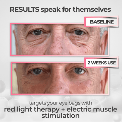 RevitalEyes® 2-in-1 Red Light Therapy + EMS To Erase Eye Bags for Men